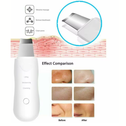 LIMPIADOR FACIAL ULTRASONICO