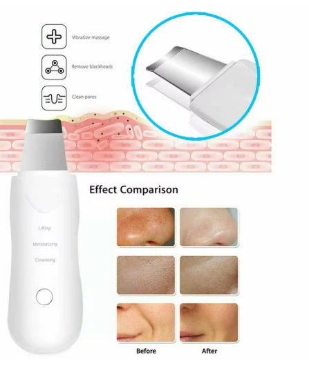 LIMPIADOR FACIAL ULTRASONICO